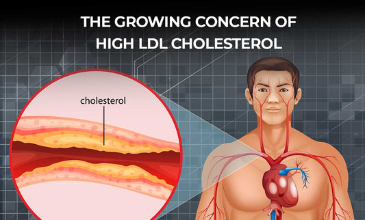 How to Lower Your Cholesterol: A Revolutionary Chilean Invention